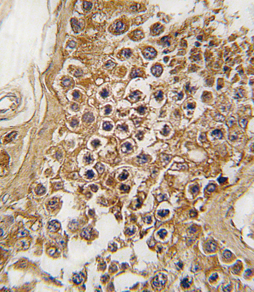 IHC-P - ALK Antibody (Center) AP7600C